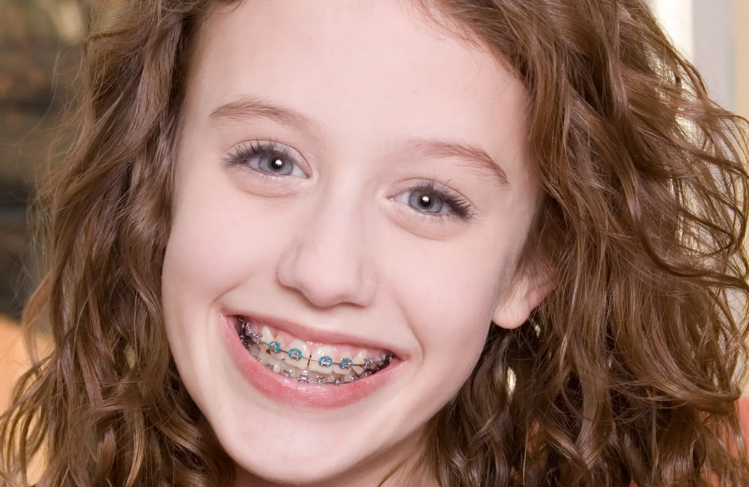 Braces for Teens Avelle Orthodontics