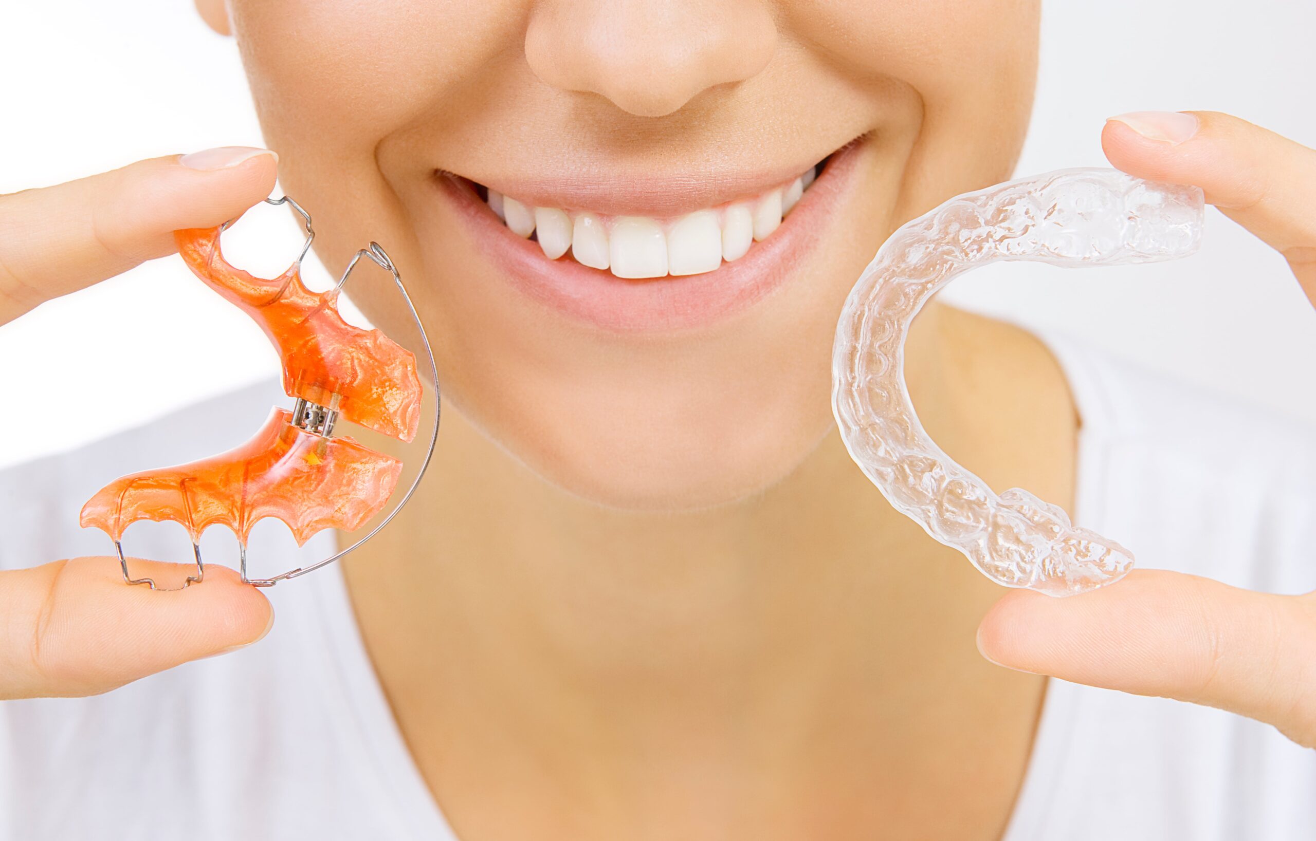 Why Your Retainer Matters scaled