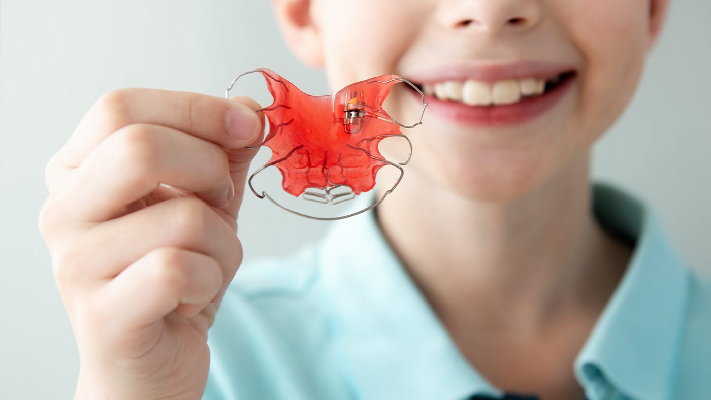 why retainers matter