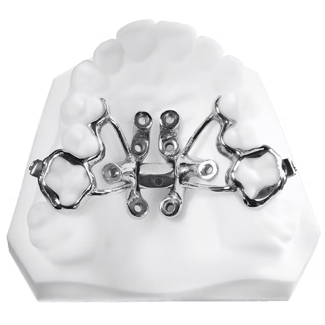 MARPE model